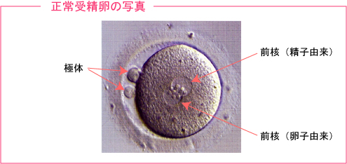 正常受精卵の写真