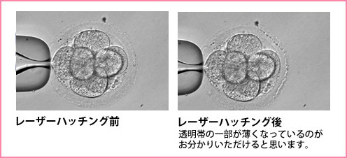 レーザーハッチング前後写真